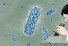 بیماری های عجیب و ترسناک