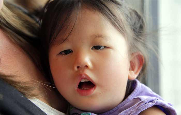 بیماری های ترسناک سندرم موگرگلیان