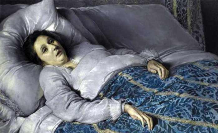 بیماری های ترسناک سندرم کتفیلد