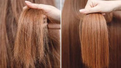 خشکی مو خشکی مو در طب سنتی